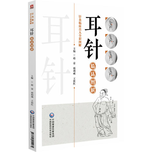 耳针临床图解 赵荣 邢利威 王祖红 针灸临床真人全彩图解 每一个章节都配以清晰的图解和案例分析9787521455175中国医药科技出版社 商品图1