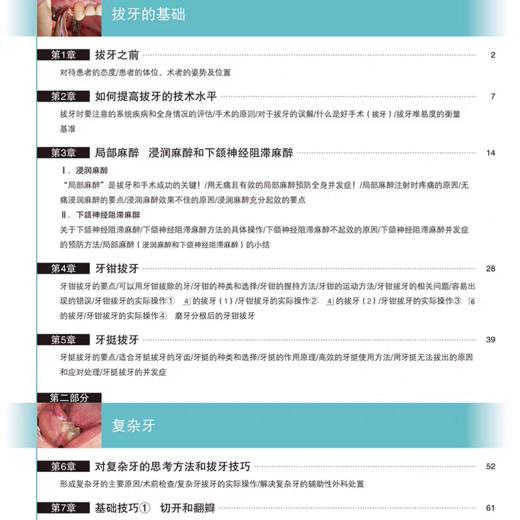 拔牙技巧必成高手进阶版 吴松涛 吴斌 主译 比第一版内容更多步骤更详细图文解释更彻底有拔牙视频教学 辽宁科学技术出版社 商品图3