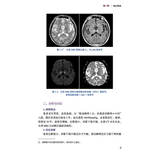 神经内科疑难病例诊治分析 刘波 唐伟 主编 精编疑难病例 凝练临床思辨 助力神经诊疗 内科学 9787524705574中国中医药出版社 商品图4