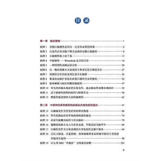 神经内科疑难病例诊治分析 刘波 唐伟 主编 精编疑难病例 凝练临床思辨 助力神经诊疗 内科学 9787524705574中国中医药出版社 商品图3
