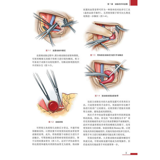 血管外科关键入路 手术精要与操作图谱 中文翻译版 沈晨阳 聚焦于血管外科手术的操作图谱 800余幅手术示意图和影像图 科学出版社 商品图4