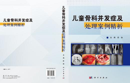 儿童骨科并发症及处理案例精析 颉强 9787030853967 商品图3