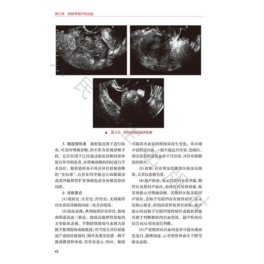 产科出血 漆洪波 赵扬玉 刘兴会 主编 全面 系统 深入地介绍产科出血疾病早期识别和诊断及精准治疗 9787117395700 人民卫生出版社 商品图4
