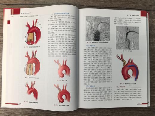 血管外科关键入路：手术精要与操作图谱（中文翻译版） （美）蒂穆尔·P.萨拉吉（Timur P.Sarac） （美）维克拉姆·S.卡夏普（Vikram S.Kashyap） 沈晨阳 9787030842 商品图7