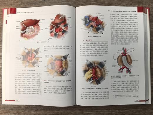 血管外科关键入路：手术精要与操作图谱（中文翻译版） （美）蒂穆尔·P.萨拉吉（Timur P.Sarac） （美）维克拉姆·S.卡夏普（Vikram S.Kashyap） 沈晨阳 9787030842 商品图4