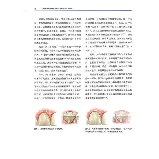口腔美学贴面修复 治疗计划和临床理念指南 周倜 董凯 周月琪 周文娟 主译 系统地阐述了贴面修复的理论与实践 辽宁科学技术出版社 商品图4