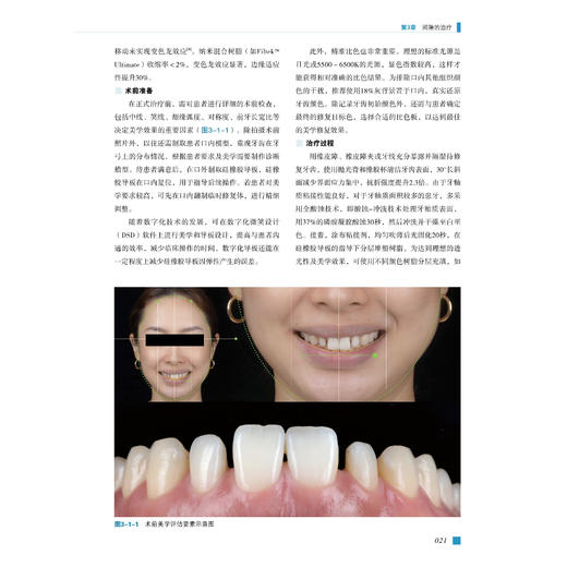 前牙美学区间隙管理 科学与临床实践 撒悦 系统梳理前牙美学区的核心概念、量化美学参数、间隙的多维成因等 辽宁科学技术出版社 商品图4