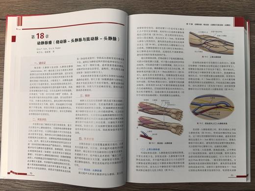 血管外科关键入路：手术精要与操作图谱（中文翻译版） （美）蒂穆尔·P.萨拉吉（Timur P.Sarac） （美）维克拉姆·S.卡夏普（Vikram S.Kashyap） 沈晨阳 9787030842 商品图5