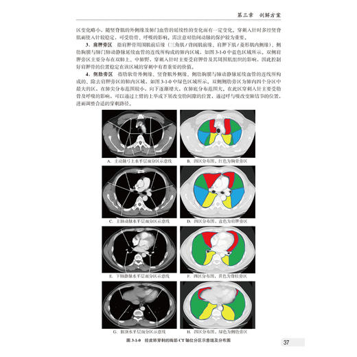 穿刺基本功 CT引导下经皮肺穿刺活检术 陈麦林 拆解经皮穿刺诊疗的每一项技术与细节 分享作者实践中的经验等 北京大学医学出版社 商品图4