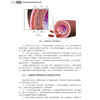 动脉粥样硬化超声诊断与治疗 孙阳 黄荣忠 冉海涛 本书全面系统论述超声技术在动脉粥样硬化诊疗领域应用的学术专著 科学出版社 商品缩略图4