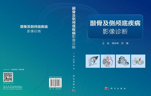 颞骨及侧颅底疾病影像诊断 刘中林 付琳 9787030852526 商品图3