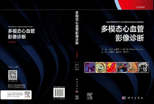 多模态心血管影像诊断（中文翻译版） （美）马里奥·J.加西亚（Mario J. Carcia） 田树平 姚洪祥 尹卫华 9787030853271 商品图3