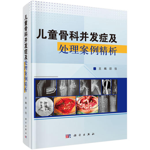儿童骨科并发症及处理案例精析 颉强 主编  本书可用于高年资小儿骨科医师、矫形骨科医师、进修医师或研究生 科学出版社 商品图1