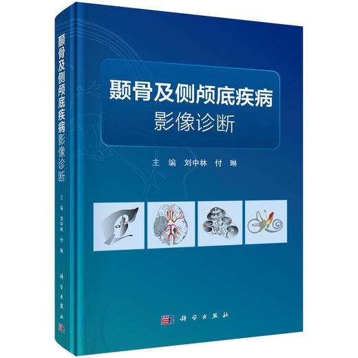 颞骨及侧颅底疾病影像诊断 刘中林 付琳 主编 本书可供神经外科、耳科和鼻科临床医师及放射影像科医师及学生阅读 科学出版社 商品图1