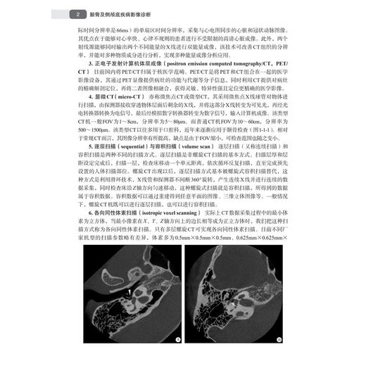 颞骨及侧颅底疾病影像诊断 刘中林 付琳 主编 本书可供神经外科、耳科和鼻科临床医师及放射影像科医师及学生阅读 科学出版社 商品图4