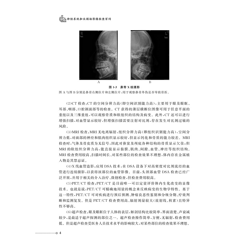 试读PDF-9787308275835(1-1)-神经系统和头颈部影像检查百问_020.jpg