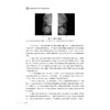 神经系统和头颈部影像检查百问/浙江省中西医结合学会影像专业委员会 浙江省医学会放射学分会 科普丛书/许茂盛 杨光钊 夏瑞明 商品缩略图4