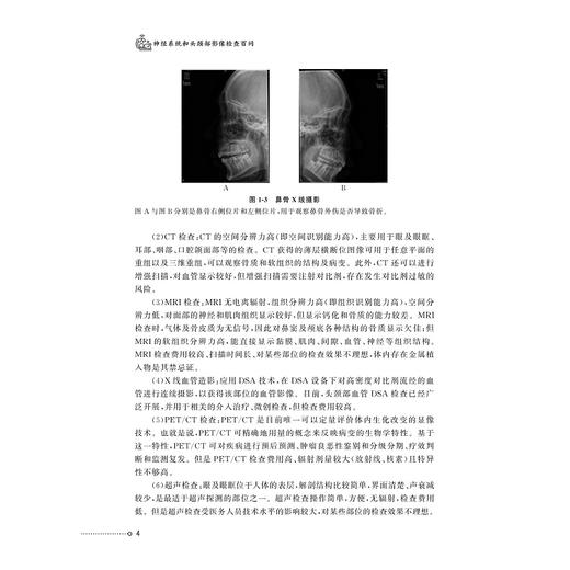 神经系统和头颈部影像检查百问/浙江省中西医结合学会影像专业委员会 浙江省医学会放射学分会 科普丛书/许茂盛 杨光钊 夏瑞明 商品图4