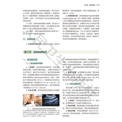 脑侧支循环及窃血血管超声评估 张雄伟 李响 杨洁 本书对神经病学多学科临床实践具有较高的指导意义及实用价值 人民卫生出版社 商品图4