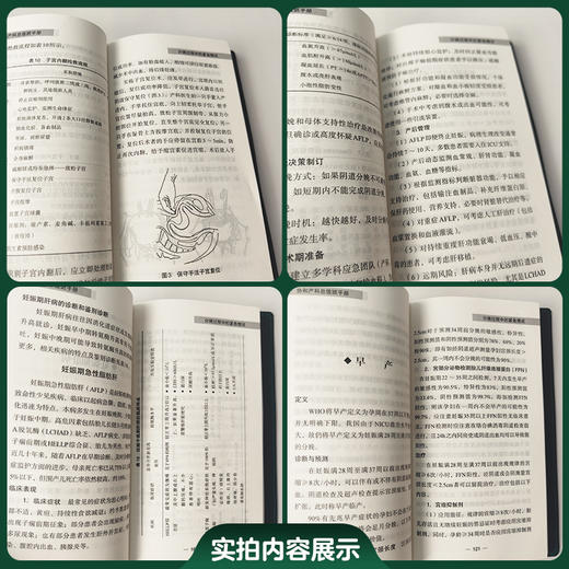 协和产科总值班手册 第2二版 付晨薇 聚焦产科总值班日常工作场景 梳理产科常规诊疗流程 9787567928664中国协和医科大学出版社 商品图2