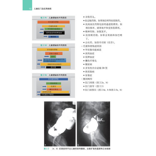 儿童肛门及肛周疾病(中文翻译版) 严志龙 褚珺 主译 详细介绍了儿童几乎所有常见的肛门及肛周病变 有炎症畸形肿瘤等 科学出版社 商品图4