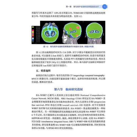 断层调强放射治疗（培训教材）曲宝林 俞伟 肿瘤放射治疗核心能力建设系列教材 供住院医师 专科医师 研究生等使用人民卫生出版社 商品图4