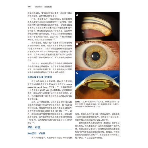 钱德勒与格兰特青光眼学 第6版 张纯 青光眼实践和外科治疗领域开创性教材 涵盖青光眼及青光眼相关的所有疾病 北京大学医学出版社 商品图4