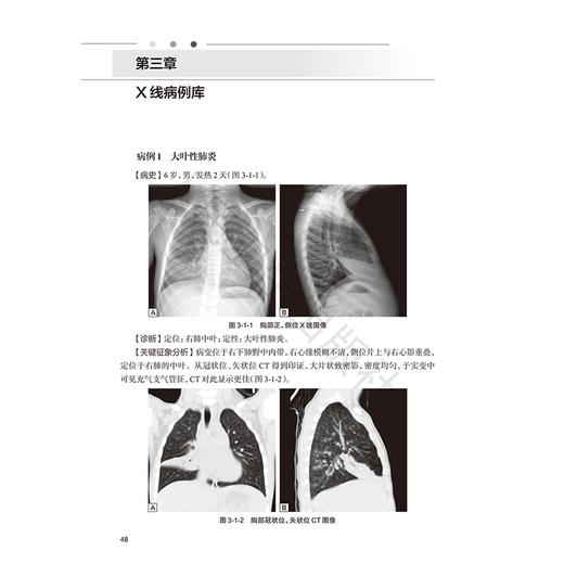 放射影像诊断基本功 刘再毅 王培军 住院医师规范化培训结业临床实践能力考核标准方案解读丛书 9787117381635 人民卫生出版社 商品图4