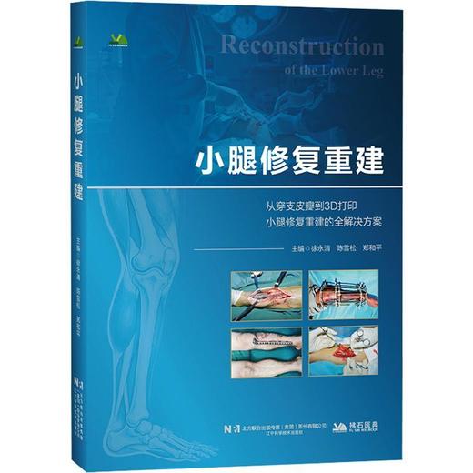 小腿修复重建 商品图0