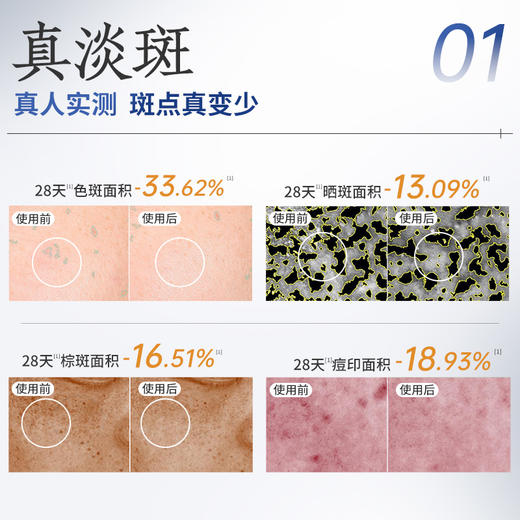 美白祛斑精华液30ml 美白祛斑特证 11种配方精简告别敏感肌肤 质地轻盈不闷 淡斑精华霜【净界之花】 商品图1