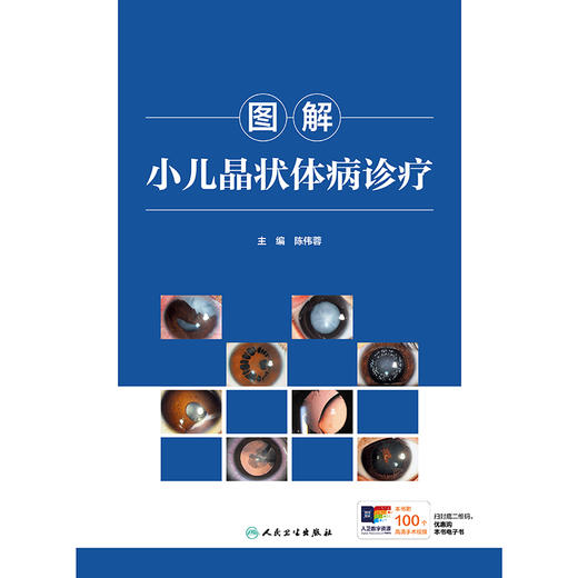 图解小儿晶状体病诊疗 商品图1