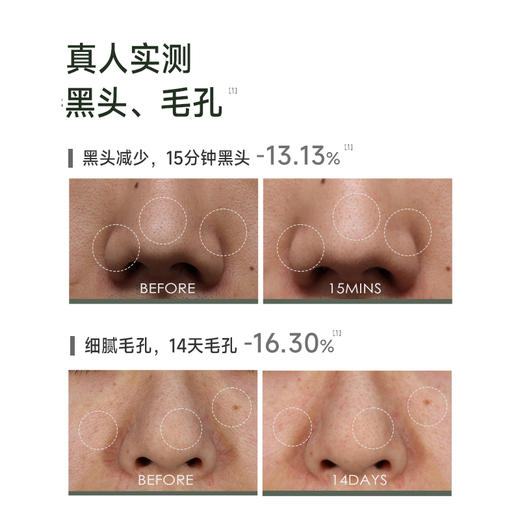 99三支【针对黑白头闭口粉刺 收缩毛孔】【好冲洗不拔干 涂膜棒不脏手】科颜萃 清洁泥膜棒 涂抹式面膜40g/支 商品图4