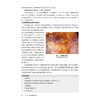 腹膜透析疑难经典病例集萃 董捷 一部来自中国腹膜透析 临床一线的实战教科书 是肾脏专科医生快速成长的案头必备 人民卫生出版社 商品缩略图4