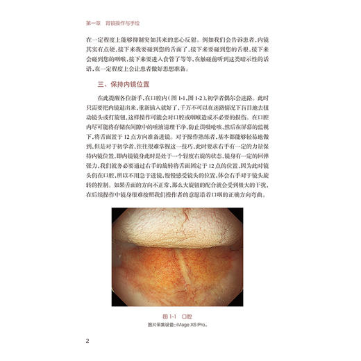 消化内镜技术手绘图解 马师洋 主编 本书共分为5章 包括胃镜操作 肠镜操作 十二指肠镜操作 微探头操作和病例荟萃 人民卫生出版社 商品图4