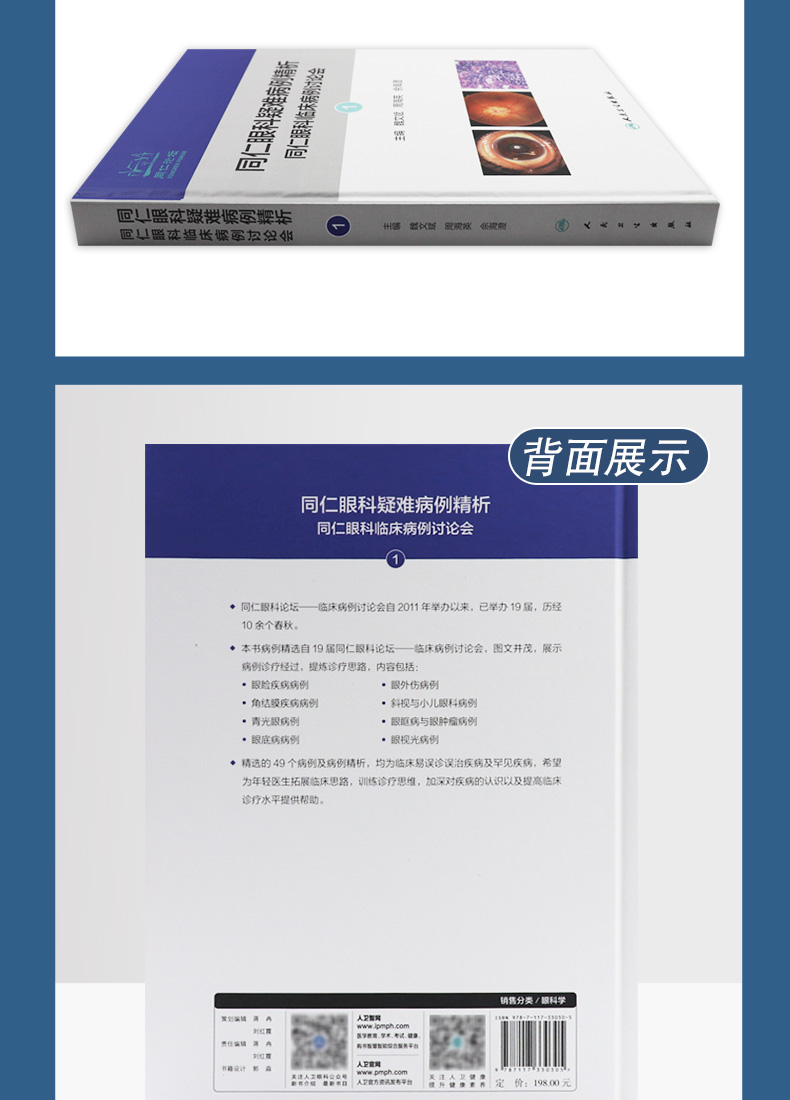 9787117330305-同仁眼科疑难病例精析:同仁眼科临床病例讨论会详情_06.jpg