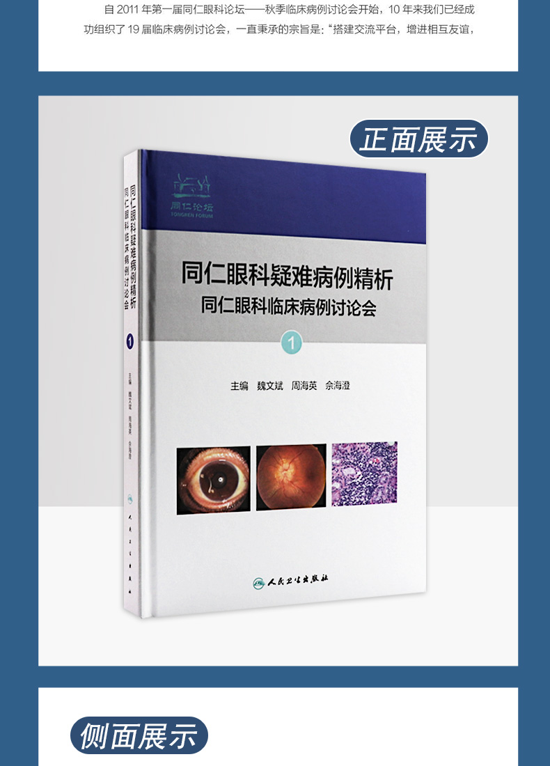 9787117330305-同仁眼科疑难病例精析:同仁眼科临床病例讨论会详情_05.jpg