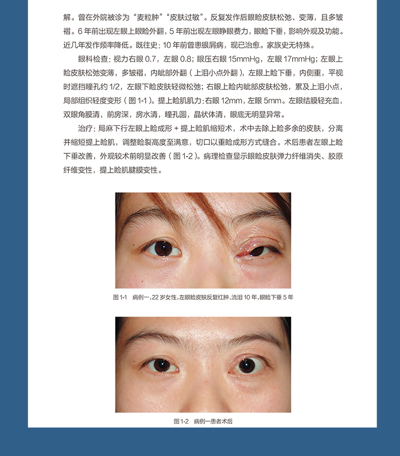 9787117330305-同仁眼科疑难病例精析:同仁眼科临床病例讨论会详情_09.jpg