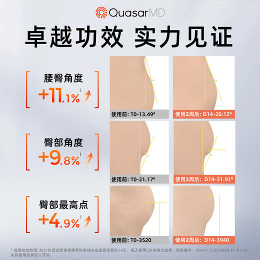 【美臀仪】科施佳光电紧塑美臀仪 商品图3