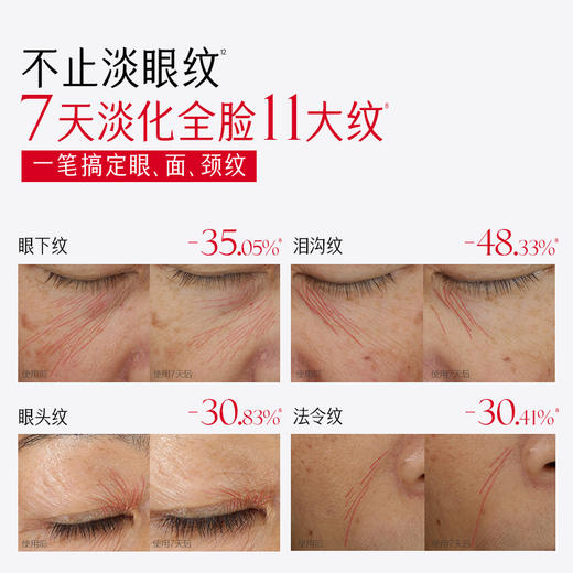 【官方正品】【🔥双𝟏𝟏年度钜惠🔥】【蔡徐坤专属】【抢代言人限定周边】【重磅升级】丸美小红笔眼霜4.0      焕亮淡纹双效升级 ，专研超级S肽，7天速淡全脸11处纹 商品图4