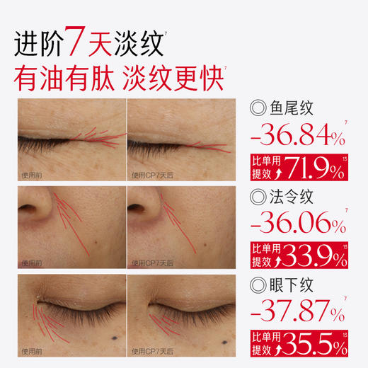 【官方正品】【🔥双𝟏𝟏年度钜惠🔥】【蔡徐坤专属】【抢代言人限定全套周边】【重磅新品】丸美小红笔CP(小红笔眼霜4.0+小红笔眼油）    ✅以油促渗✅以霜封养，滋润淡纹功效加倍 商品图6
