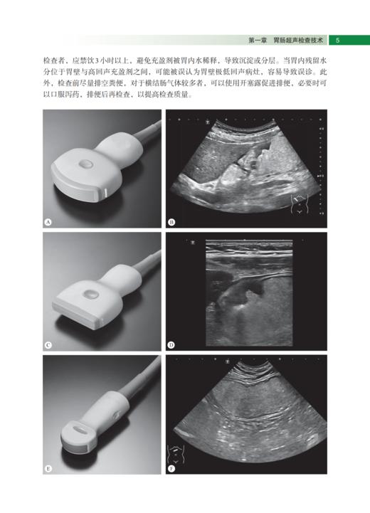 胃肠超声医学 陈志奎 9787030841872 商品图9