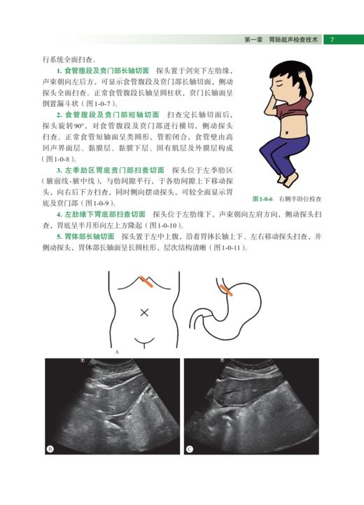 胃肠超声医学 陈志奎 9787030841872 商品图11