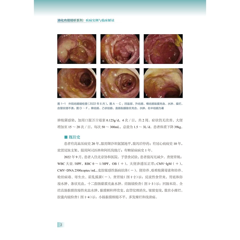 试读PDF-9787308275460(1-1)-胃肠道淋巴瘤内镜实录:精选病例解析_012.jpg
