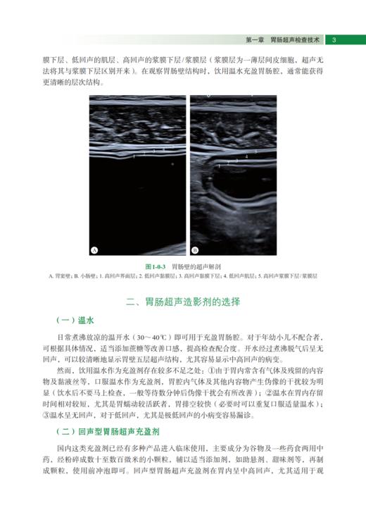 胃肠超声医学 陈志奎 9787030841872 商品图7