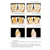 牙科瓷美学仿真图谱 岳莉 主编 本书主要内容为各类瓷美学修复的仿真制作技术，包括美学诊断蜡型制作技术等内容 人民卫生出版社 商品缩略图4