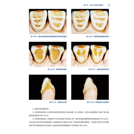牙科瓷美学仿真图谱 岳莉 主编 本书主要内容为各类瓷美学修复的仿真制作技术，包括美学诊断蜡型制作技术等内容 人民卫生出版社 商品图4