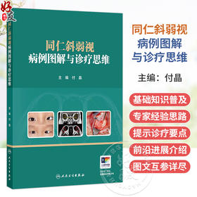 同仁斜弱视病例图解与诊疗思维 付晶 主编 共分为6章 依次围绕弱视 共同性内斜视 共同性外斜视及其他特殊病例展开 人民卫生出版社