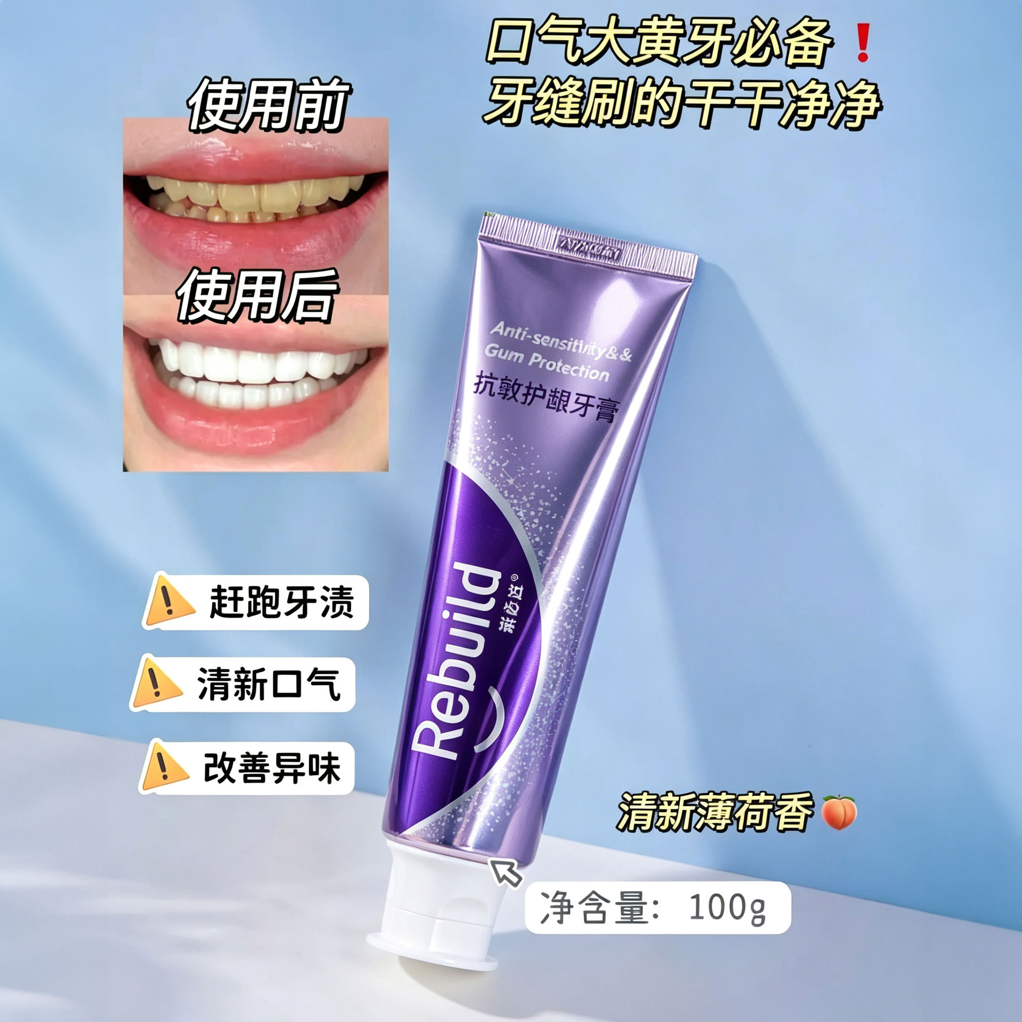 热卖！牙齿“金钟罩”！免费试用20g!【北大博士科研团队研发】诺必达 抗敏护龈牙膏 深层修护牙本质 长效隔绝冷热敏感 100g/支