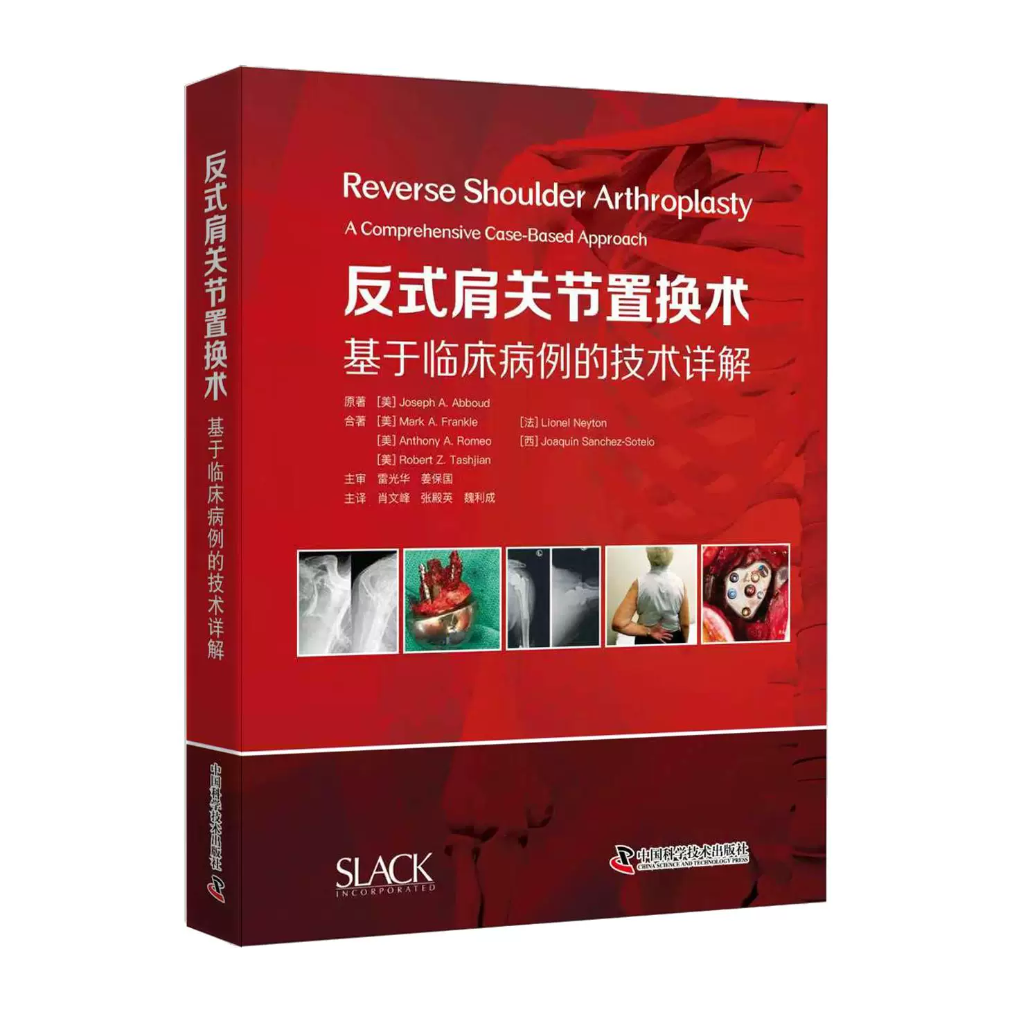 反式肩关节置换术：基于临床病例的技术详解  主审   雷光华  姜保国   辽科出版