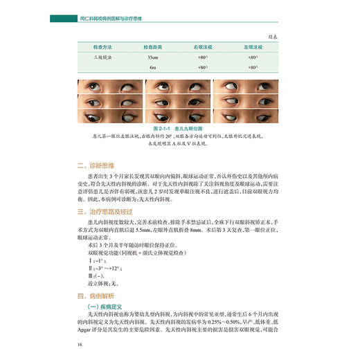 同仁斜弱视病例图解与诊疗思维 付晶 主编 共分为6章 依次围绕弱视 共同性内斜视 共同性外斜视及其他特殊病例展开 人民卫生出版社 商品图4